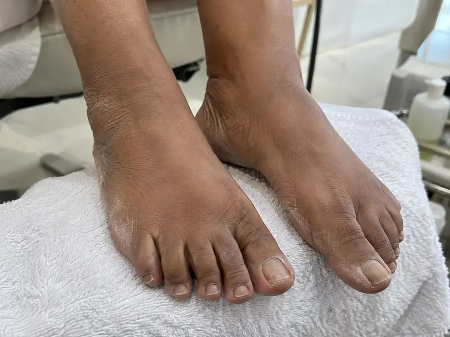 Unhas dos pés antes do cuidado e da esmaltação